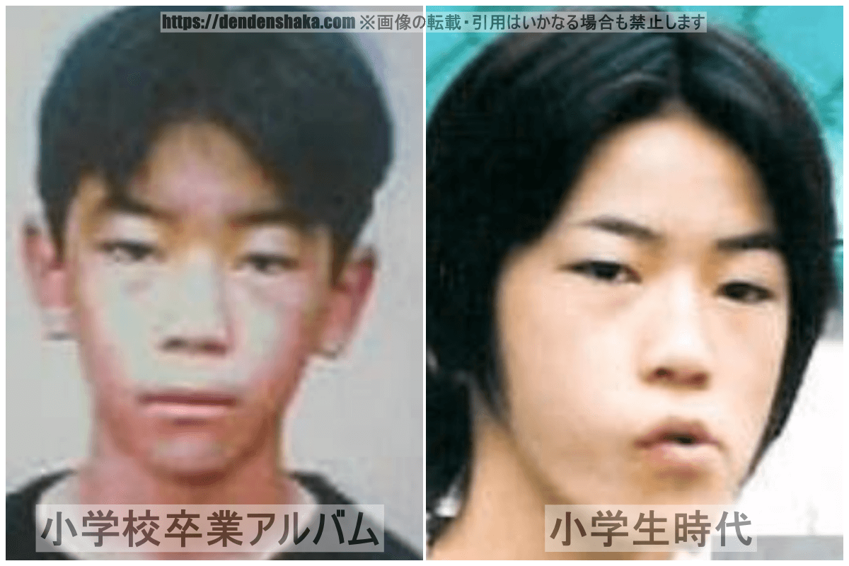 亀梨 和 也 整形 前