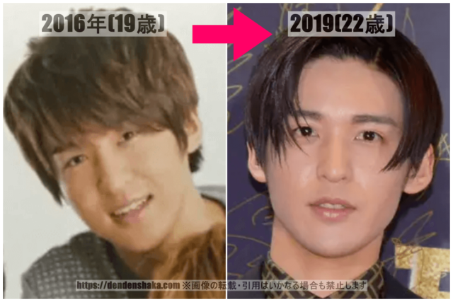 2016年(19歳当時)と2019年(22歳当時)の目黒蓮の昔の写真を並べて整形疑惑が浮上したことを説明した画像