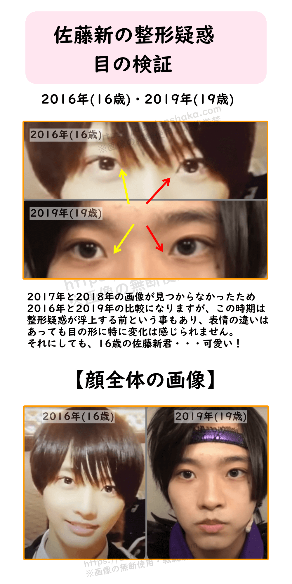佐藤新整形疑惑・目の検証①2016年(16歳)・2019年(19歳)2017年と2018年の画像が見つからなかったため2016年と2019年の比較になりますが、この時期は整形疑惑が浮上する前という事もあり、表情の違いはあっても目の形に特に変化は感じられません。それにしても、16歳の佐藤新君・・・可愛い! https://dendenshaka.com※画像の無断使用・転載厳禁