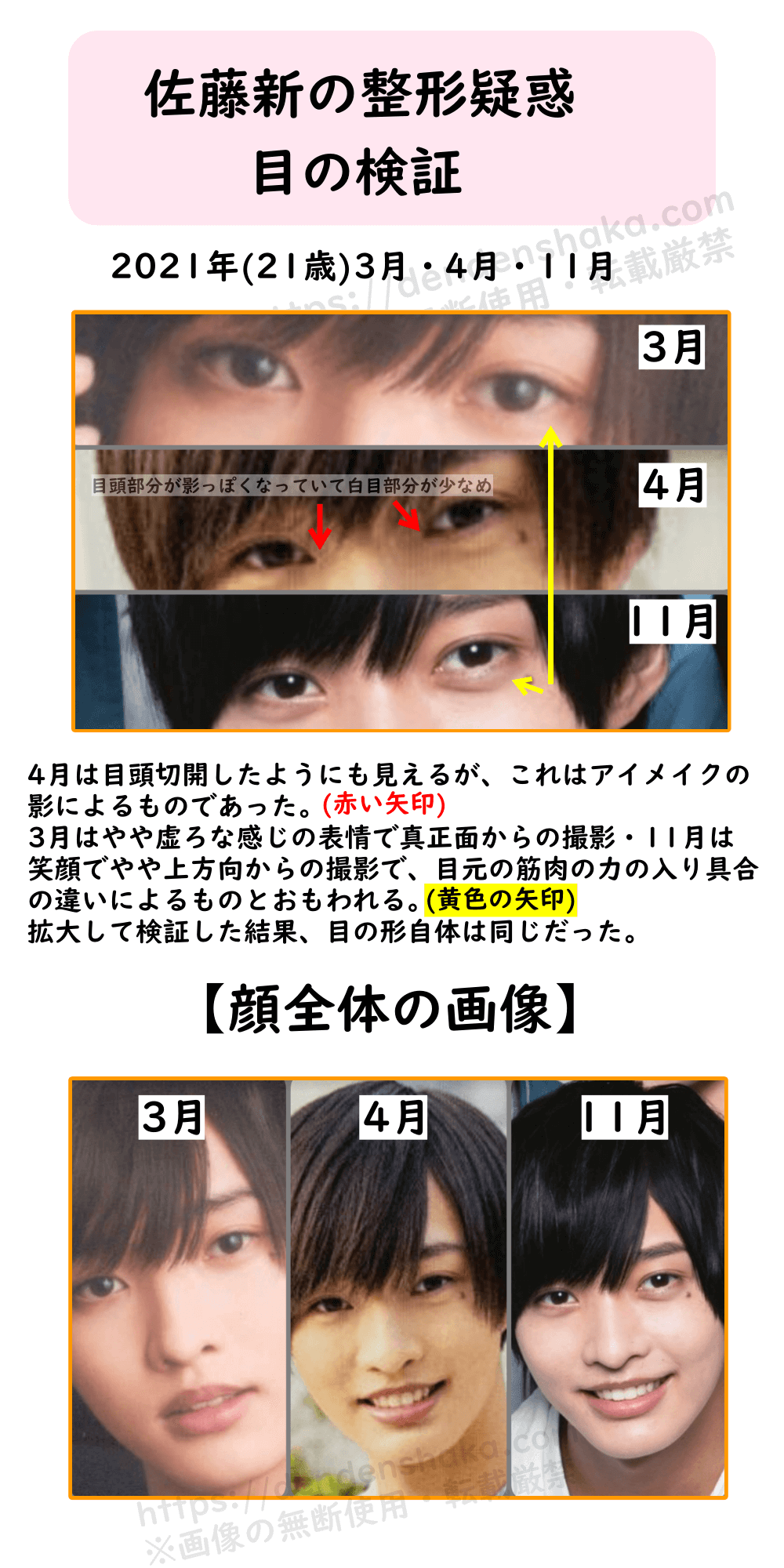 佐藤新整形疑惑・目の検証③2021年(21歳)3月・4月・11月4月は目頭切開したようにも見えるが、これはアイメイクの 影によるものであった。 3月はやや虚ろな感じの表情で真正面からの撮影・11月は 笑顔でやや上方向からの撮影で、目元の筋肉の力の入り具合 の違いによるものとおもわれる。 拡大して検証した結果、目の形自体は同じだった。