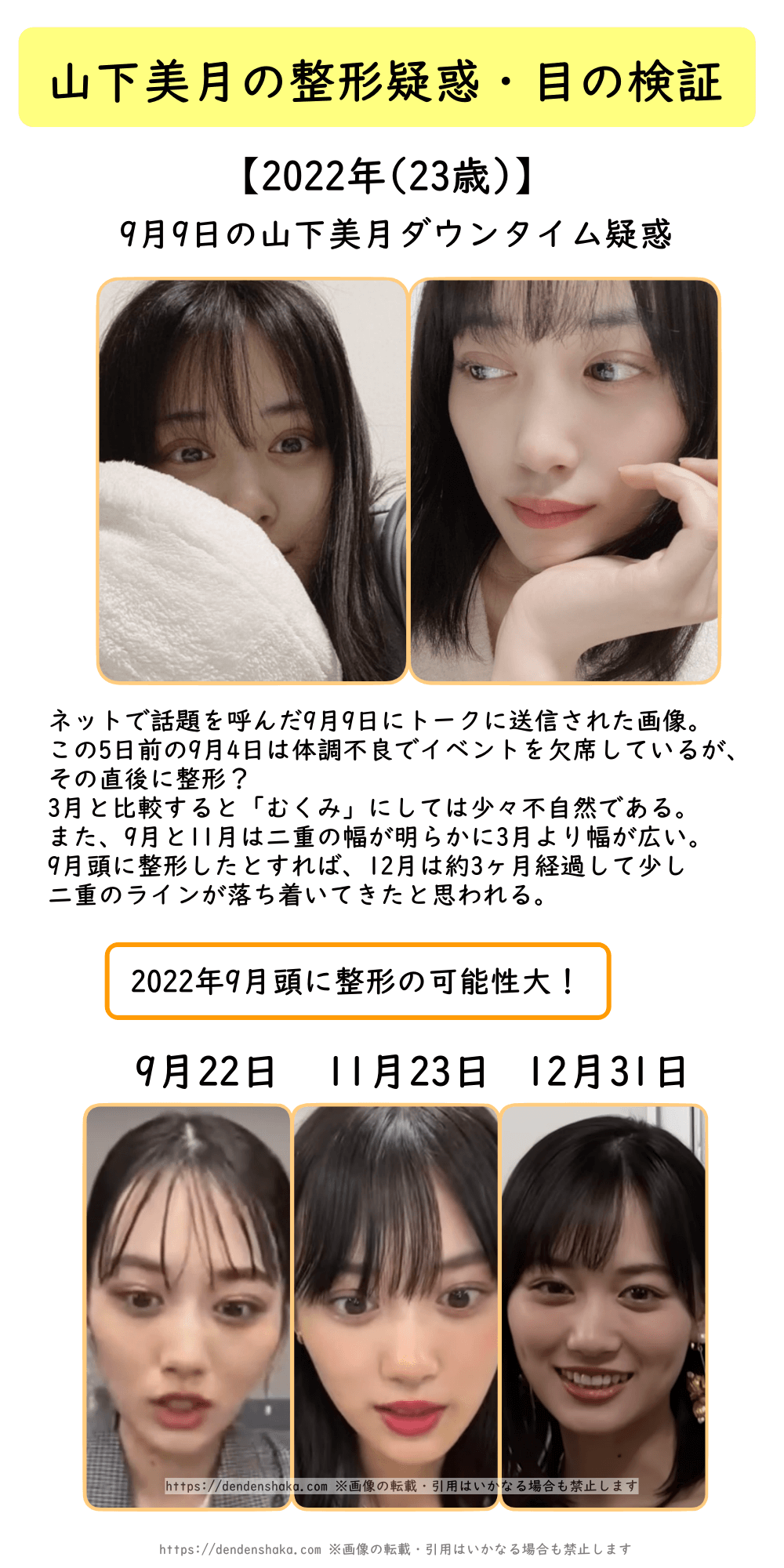 山下 美 月 整形