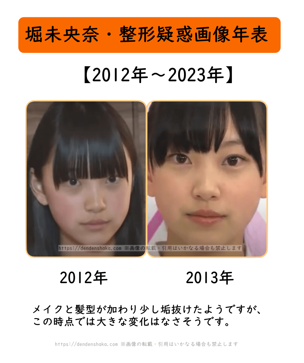 堀 未 央奈 整形