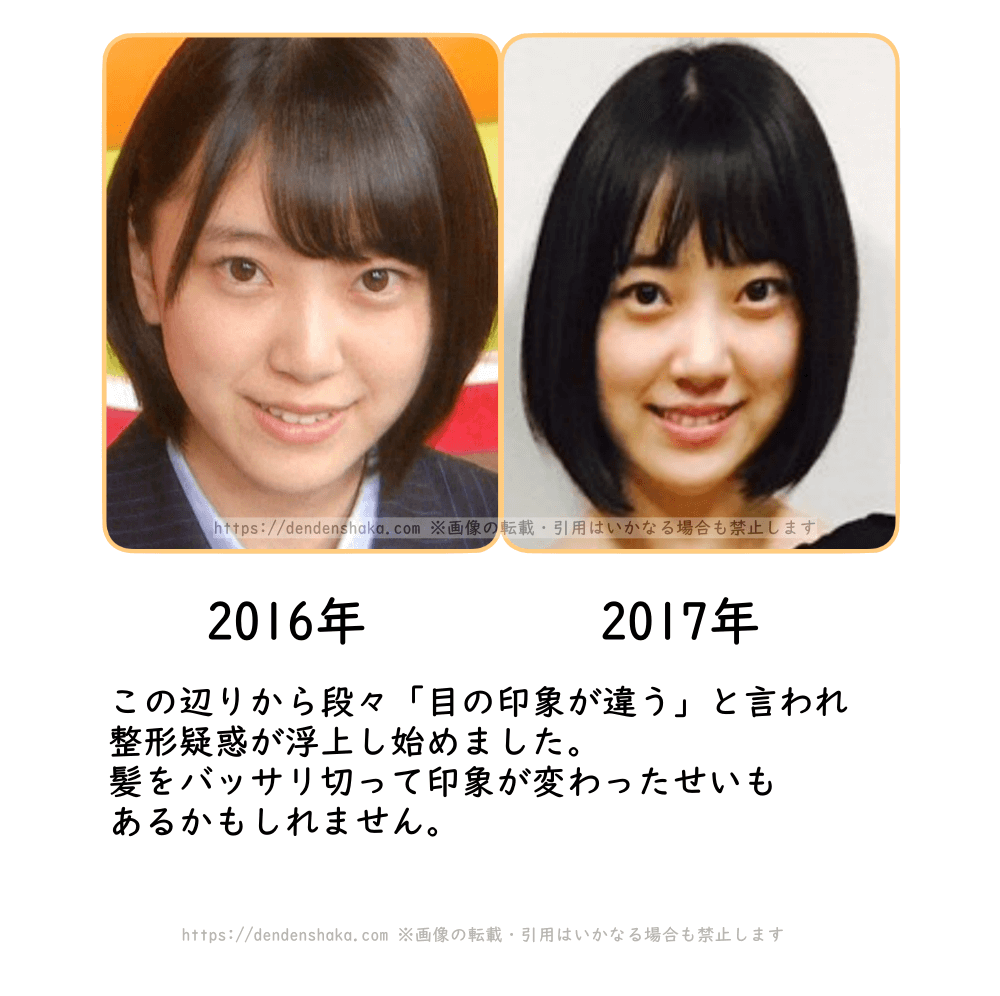 堀 未 央奈 整形