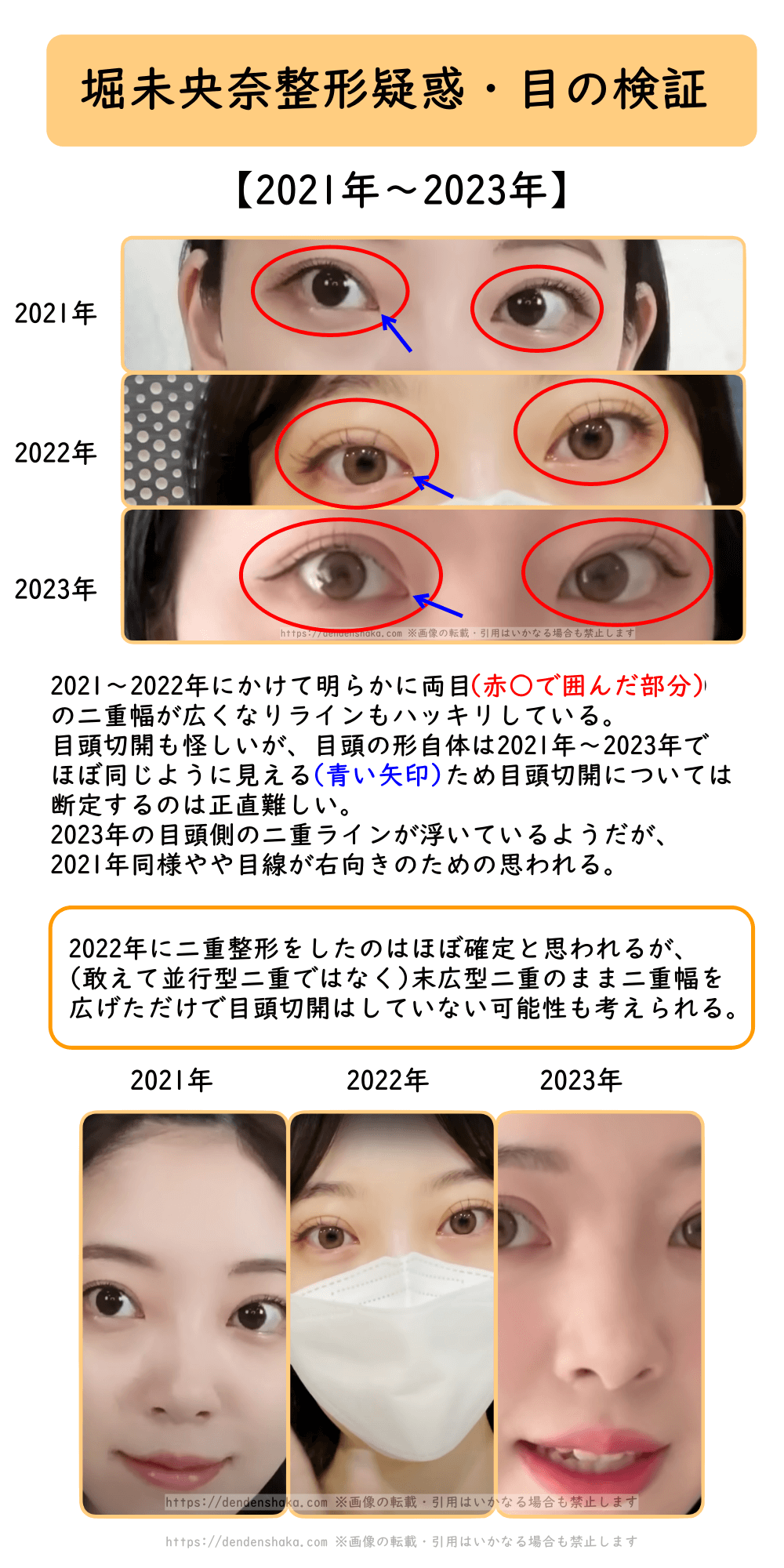 堀 未 央奈 整形