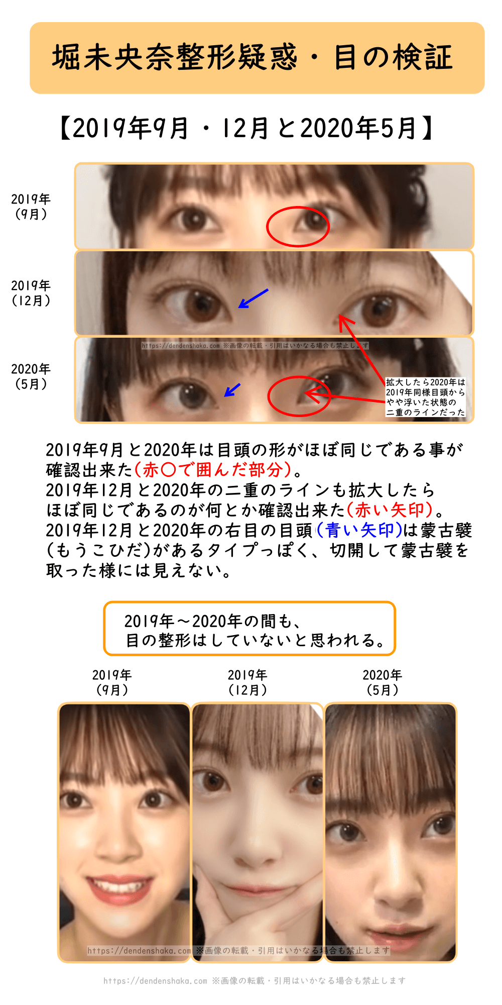 堀 未 央奈 整形