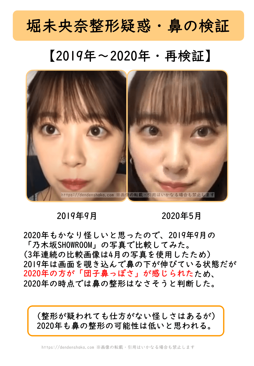 堀 未 央奈 整形