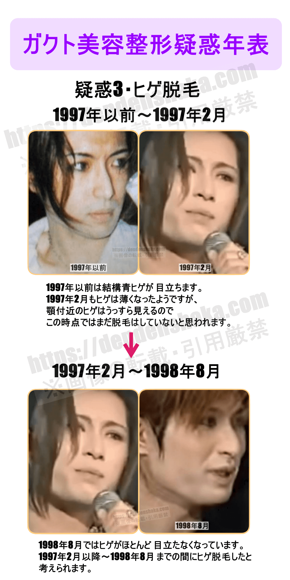 ガクト 昔 の 顔