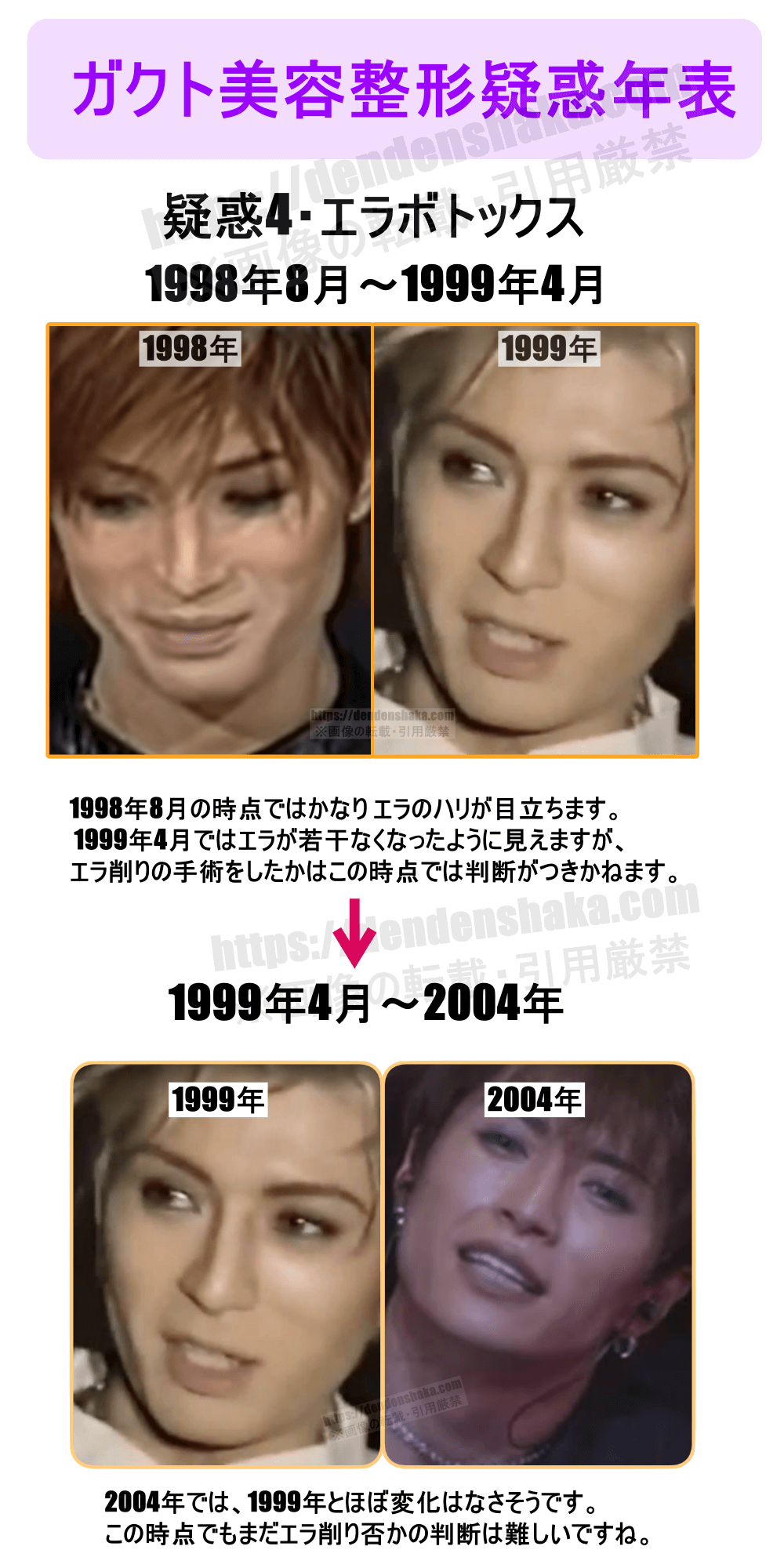 ガクト 昔 の 顔