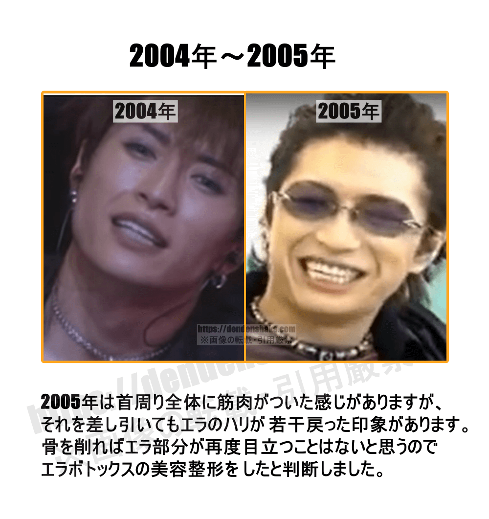 ガクト 昔 の 顔