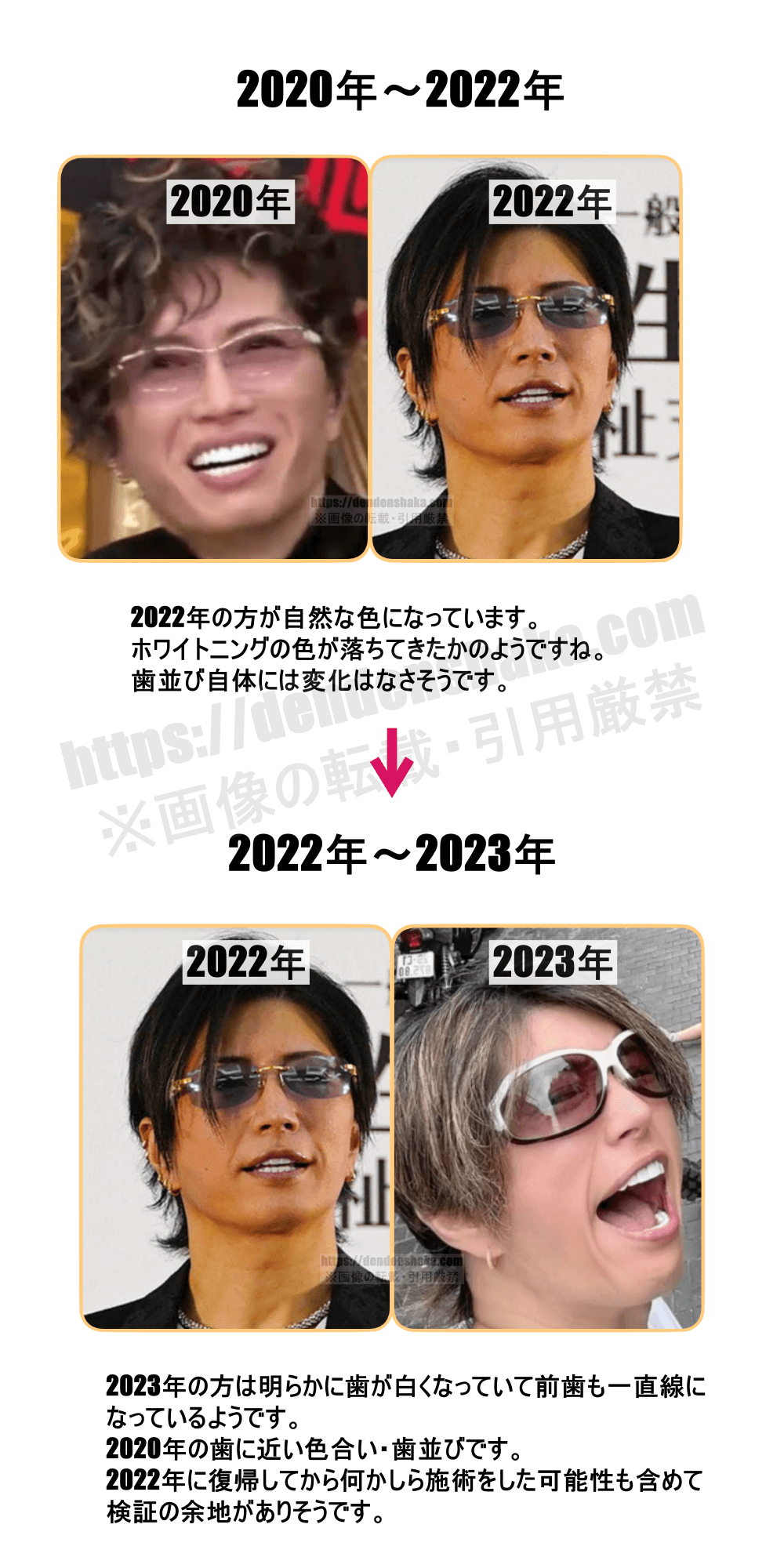 ガクト 昔 の 顔